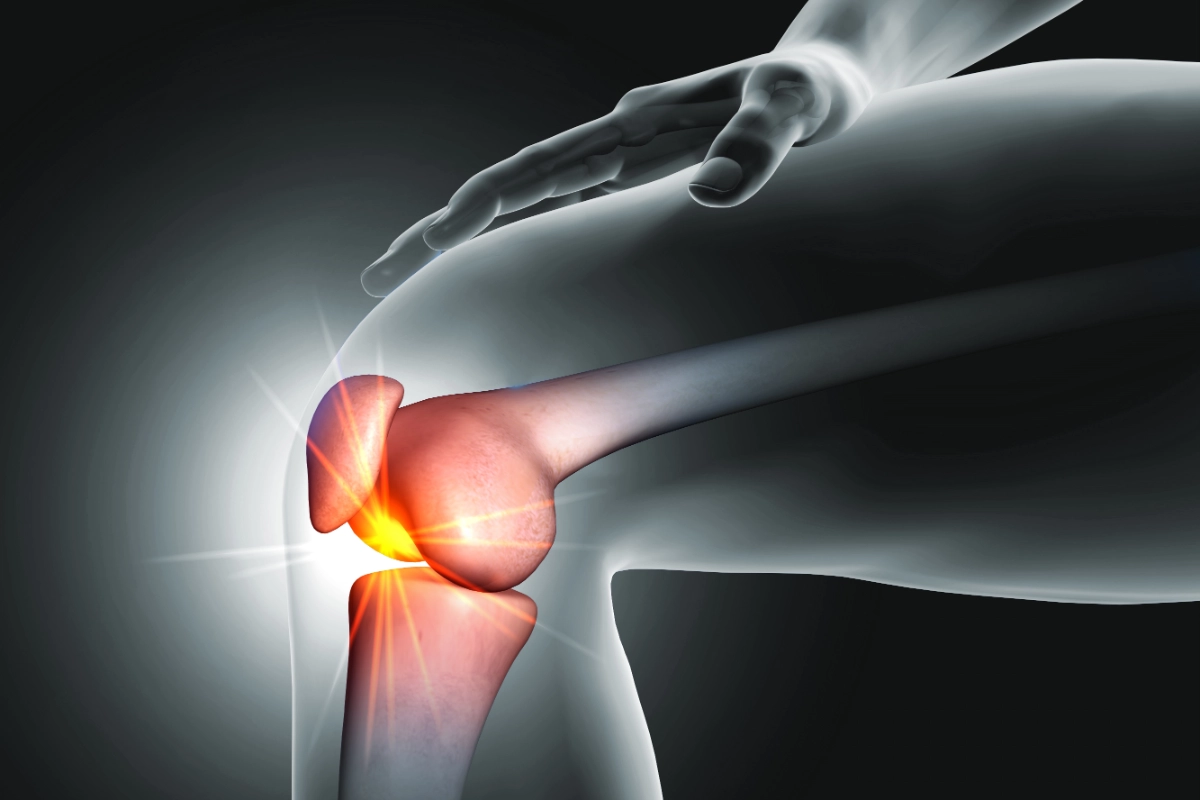 Kniegelenk vor Gelenkersatz