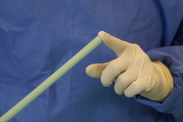 PALACADEMY - Arzt, der einen Finger-Test durchführt um zu sehen, ob der Knochenzement bereit zur Applikation ist