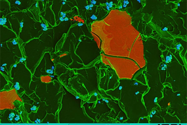 eLearning PMMA Bone Cement as an Active Ingredient Carrier