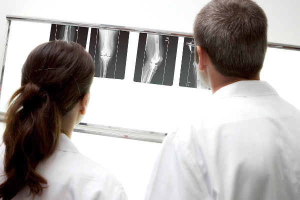 Surgeons checking x-ray images