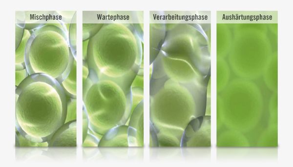 Verarbeitungsphasen Knochenzement: Mischphase, Wartephase, Verarbeitungsphase, Aushärtungsphase