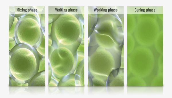 Working phases of bone cement: mixing phase, waiting phase, working phase, curing phase